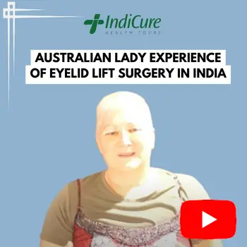 An Australian Lady's Experience of Eyelid Lift Surgery in India with IndiCure: A Personal Story
